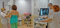 El Servicio de Radiodiagnóstico de la Arrixaca ha instalado su cuarto mamógrafo en su sección de mama (2)