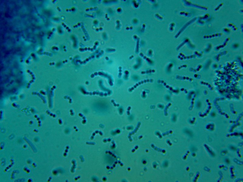 Comunidad microbiana presente en una alcuota de yougur comercial