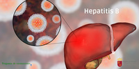 Las hepatitis m&aacute;s frecuentes en Espa&ntilde;a son A, B y C