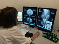 La nueva metodolog&iacute;a permitir&aacute; ganar en precisi&oacute;n, complementando el trabajo de los profesionales en la detecci&oacute;n del c&aacute;ncer de mama.