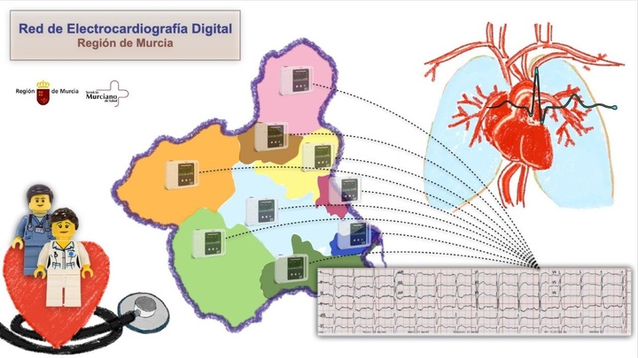 El Servicio Murciano de Salud ha creado una red de electrocardiografía digital que integra los electrocardiogramas de los hospitales y centros de salud de la Región de Murcia
