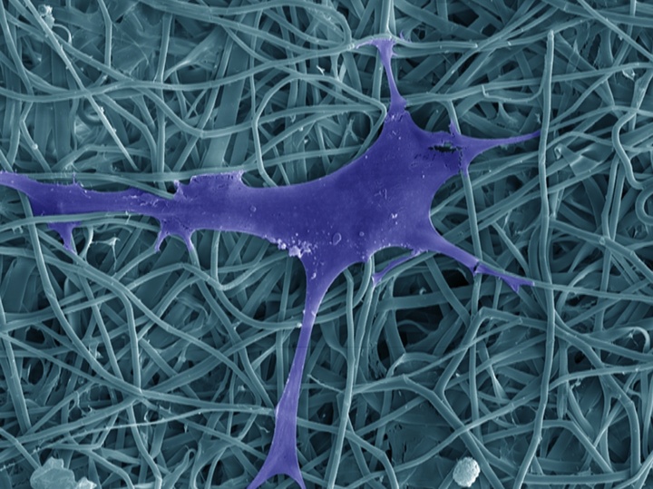 La imagen muestra una célula mesenquimal humana creciendo en una malla de nanofibras de fibroína