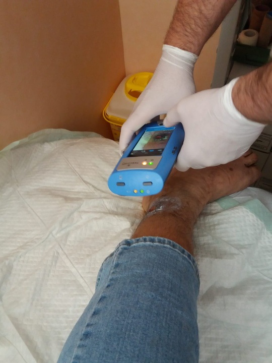 Sistema para detectar de manera precoz las infecciones en las heridas crónicas